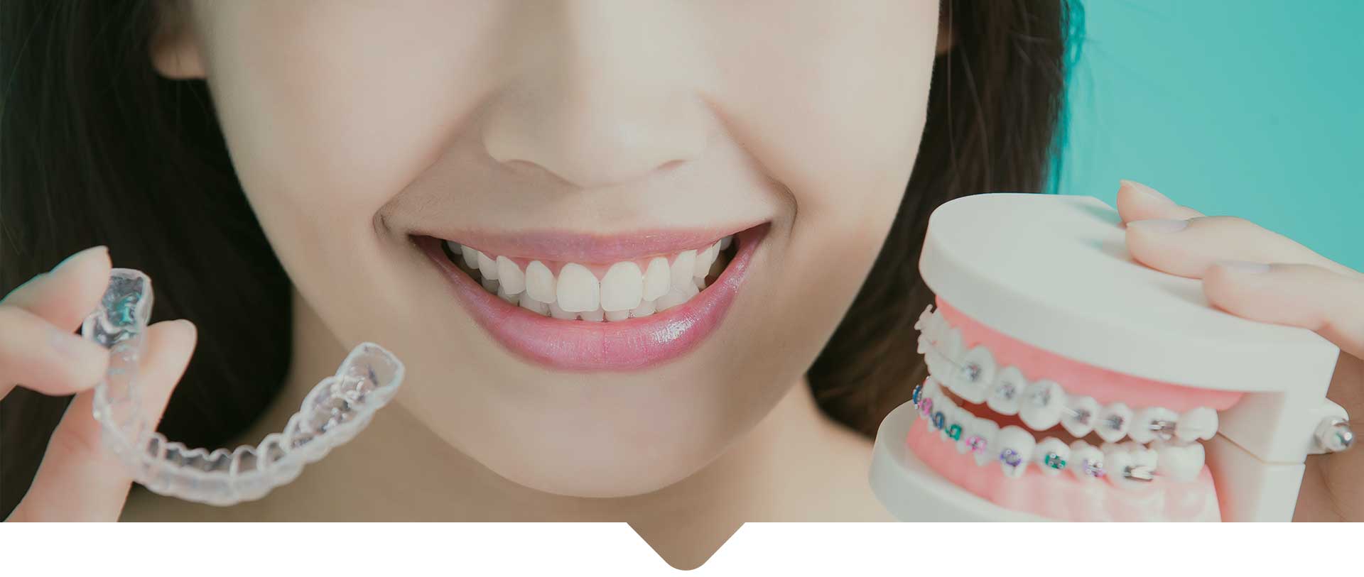 A smiling woman holding Invisalign and teeth braces towards the camera