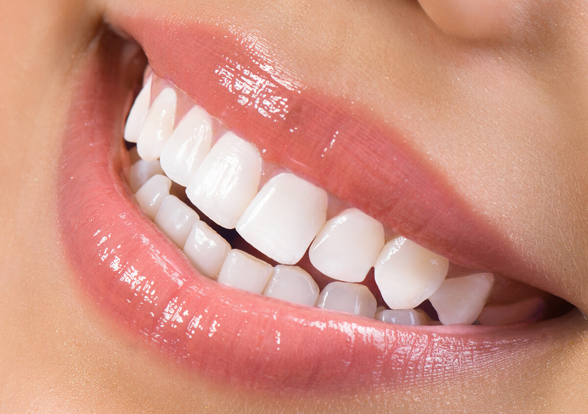 Teeth Whitening Dentist in San Diego CA Area