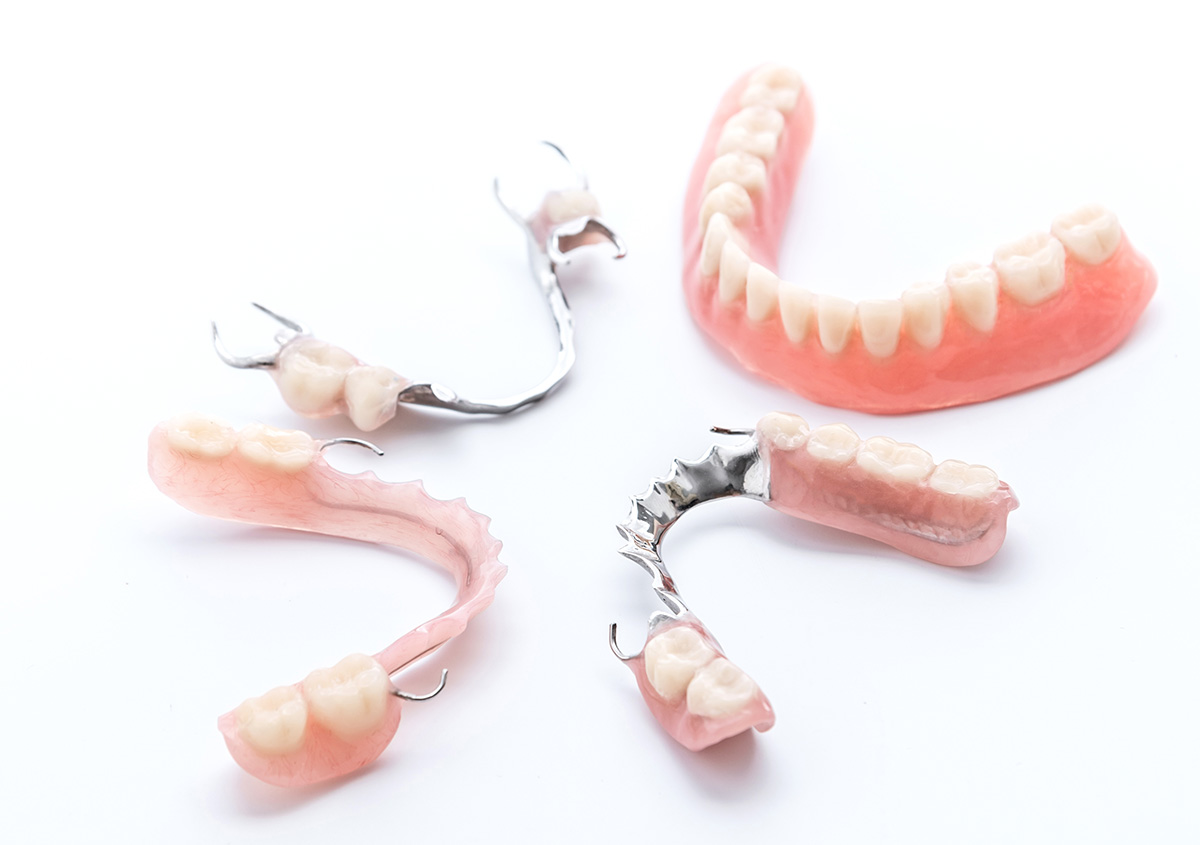 Can Partial Dentures Cause Any Health Issues in San Diego Area